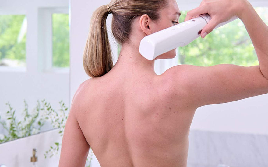 Tanning Bed Rash: Why It Happens?